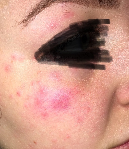 To ask what the hell is wrong with my face!