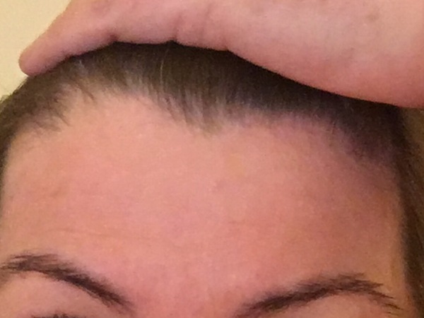 Help I’ve just looked in the mirror and at 43 I’ve turned into a wrinkly hag