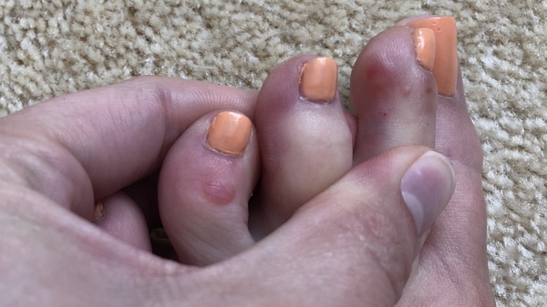 What are these on my feet? With pics.