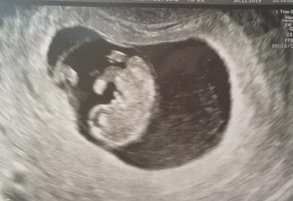 Anyone due July 2020