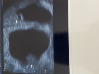 Anyone due August 2020?