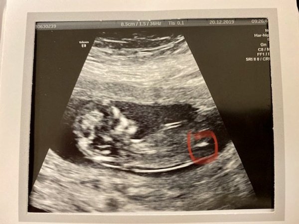 Is this the nub?