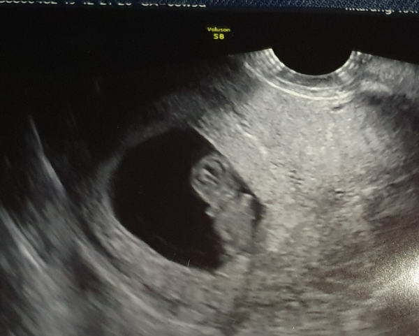 7dpo tummy cramps