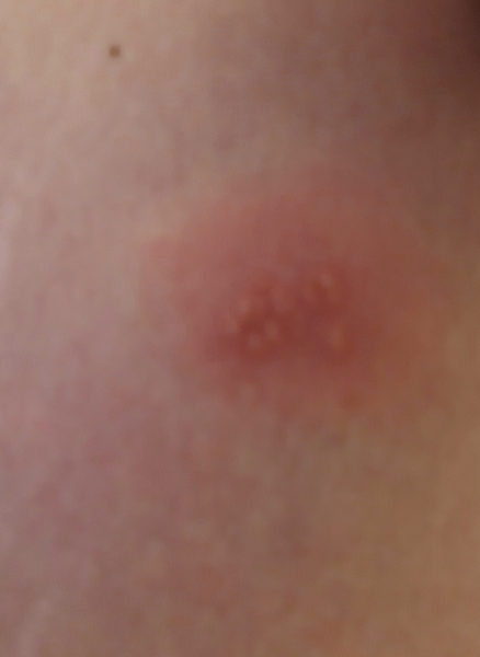 ...to ask you to diagnose this