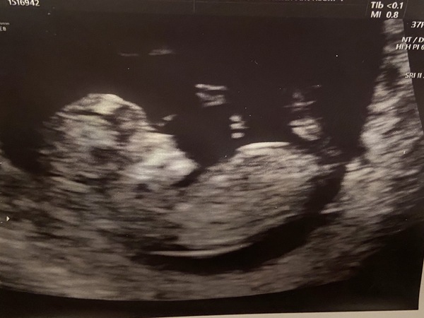 Any gender guesses please?