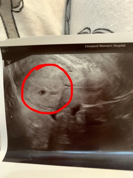 Anyone due August 2020?