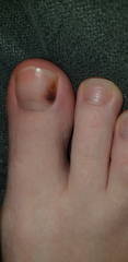 Should I be worried (health)or aibu?