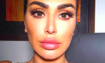 Lip Fillers