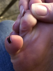 What are these on my feet? With pics.