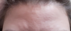 I can't tell what skincare I need.