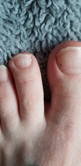 Should I be worried (health)or aibu?