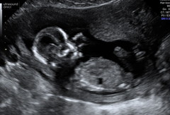 Gender guesses for fun 🧐