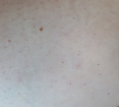 Any ideas what these are?