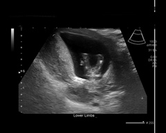 Baby gender?