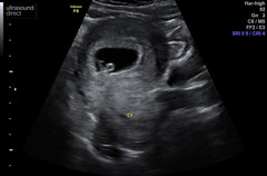 Anyone due August 2020 pt II