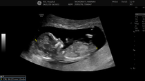 Boy or Girl?!