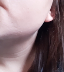 I can't tell what skincare I need.