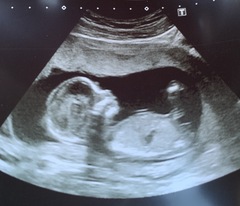 Boy or girl?!