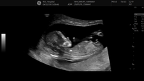 Boy or Girl?!