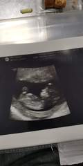 Gender guesses?