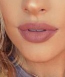 Lip Fillers