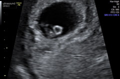 Anyone due August 2020 pt II