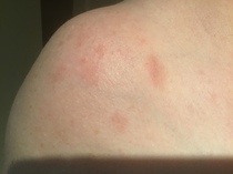 What are these ‘spots’.... (picture attached)