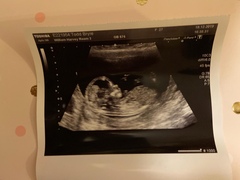 Gender guesses for fun 🧐