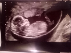 Nub theory?boy or girl💙💕