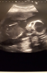Gender guesses for fun 🧐