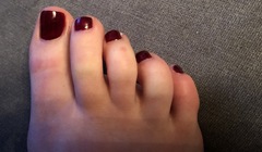 What are these on my feet? With pics.