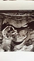 GIRL OR BOY 13 weeks