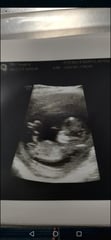 Gender guesses?