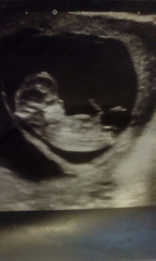 Nub theory?boy or girl💙💕