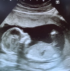 Boy or girl?!