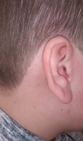 Is there anything else I can do to help DS's sore ear? He's in agony.