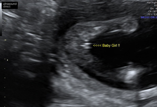 Due June 2020: Thread 3