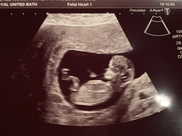 Babies due August 2020