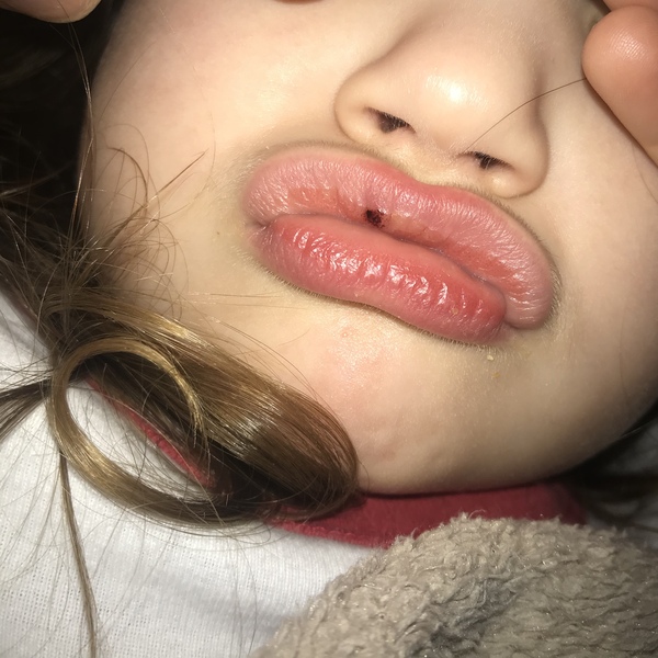 What is this on DD’s lip?