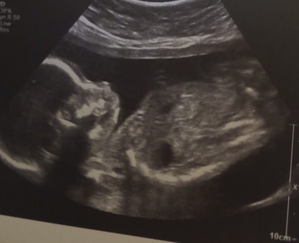 Due May 2020 (Thread 4)