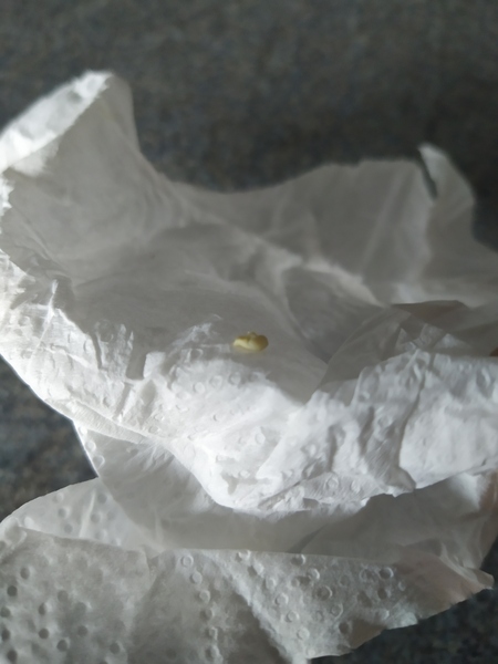 Sorry gross out klaxon! Any dentist around to help?