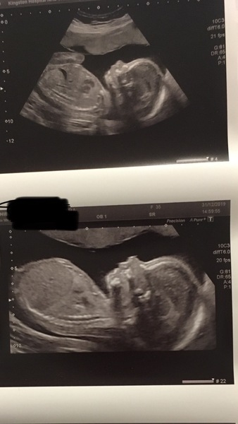 Due May 2020 (Thread 4)