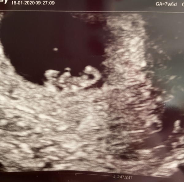 Scan photos at 7-8 weeks please