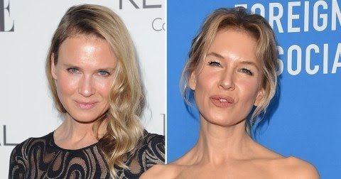 To think that a lot of genuinely beautiful people ruin themselves with plastic surgery etc?