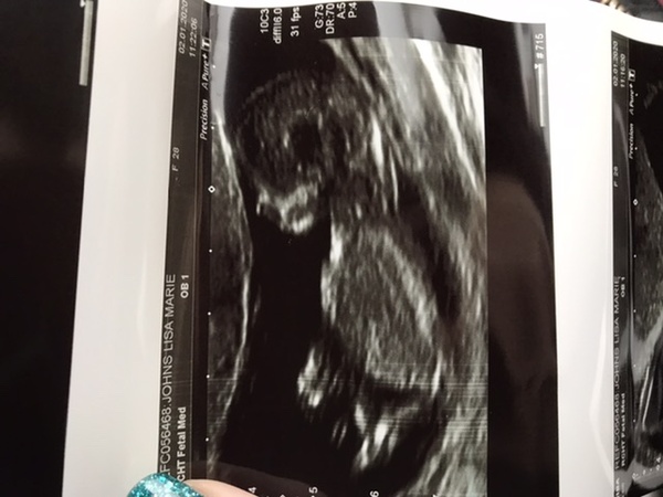 July 2020 - thread 2