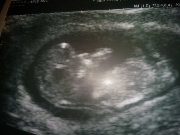 Babies due August 2020