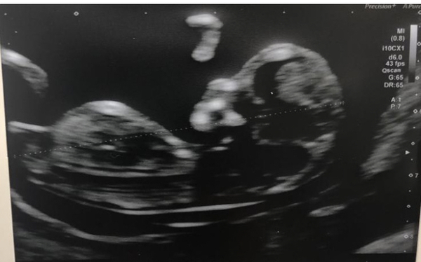 Girl or boy?