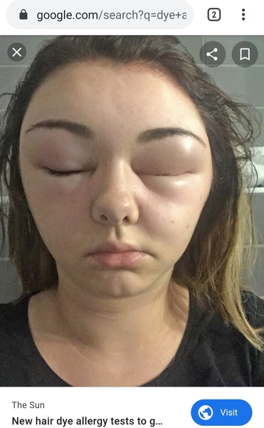 to not do a patch test before dying my hair?