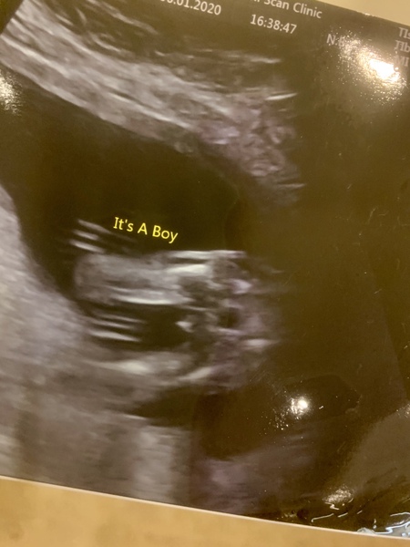 Gender confusion please help.