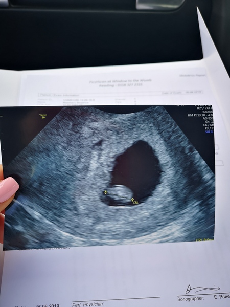 Does anyone have any 7 week scans they can share?
